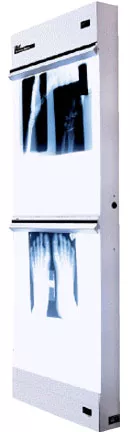 Wolf X-Ray Trimline Basic Illuminator, Standard 14" x 17" - Medex Supply